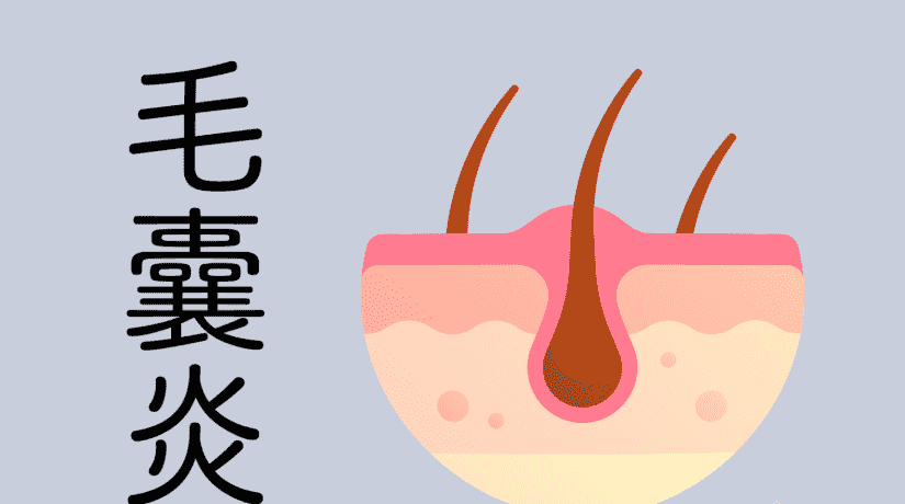毛囊炎症狀