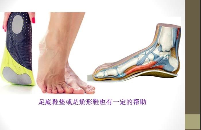足底筋膜炎治療方法 足底筋膜炎治療方法