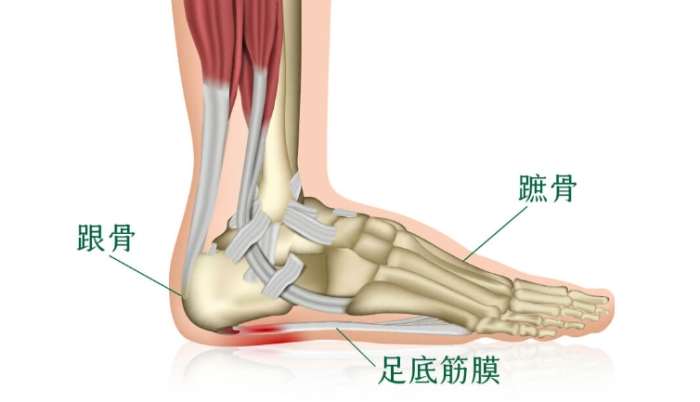 足底筋膜炎吃什麼藥 足底筋膜炎吃什麼藥