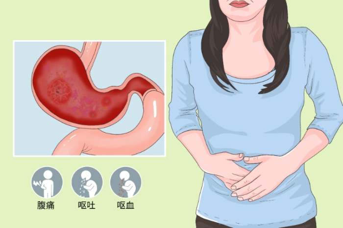急性腸胃炎原因 急性腸胃炎原因