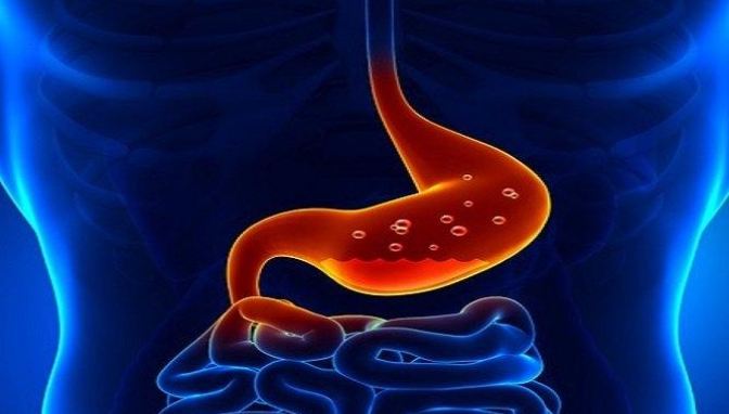 急性腸胃炎治療 急性腸胃炎治療