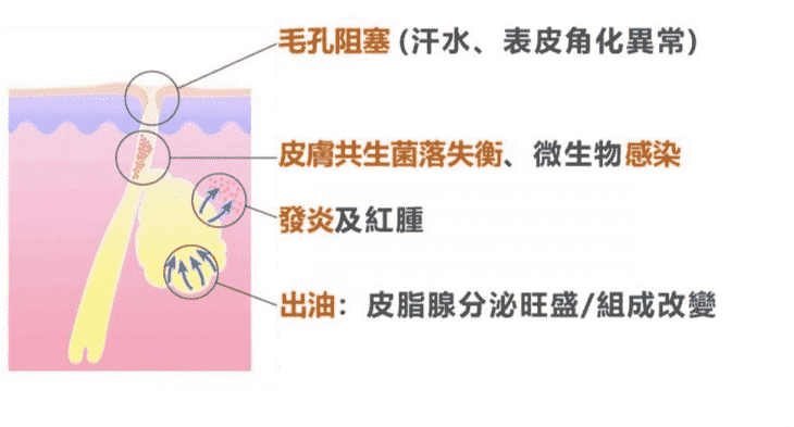 毛囊炎原因 毛囊炎原因
